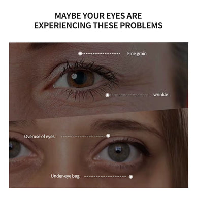 Reveal Youthful, Bright Eyes Today
